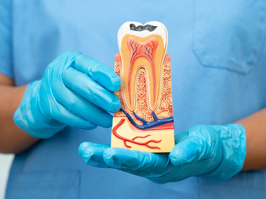 Endodontics and Root Canal Therapy