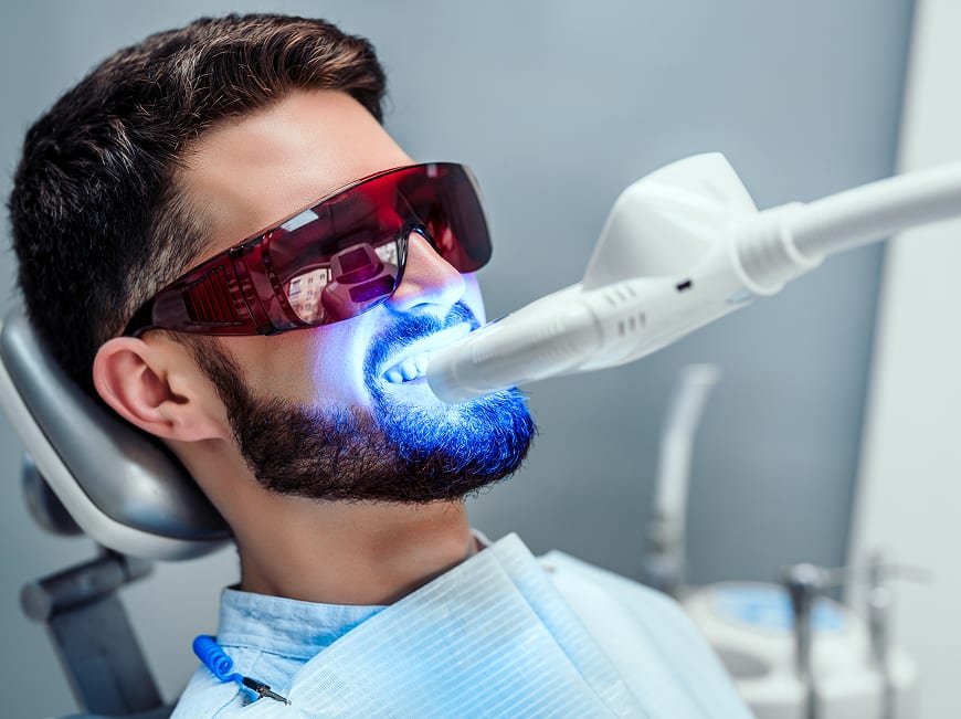 Professional Teeth Whitening